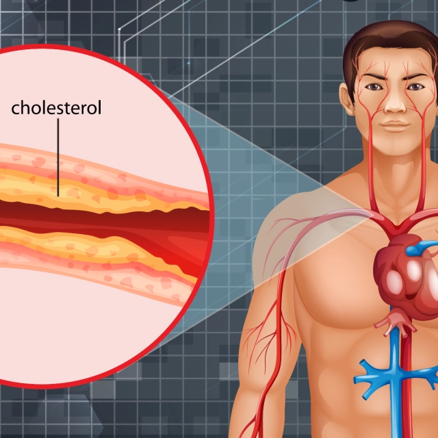 Cholesterol - hodnoty v tabulce podle věku